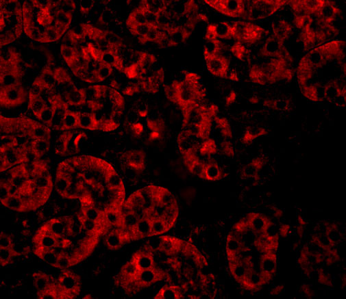 a16718 jmjd8 primary antibodies if testing 3