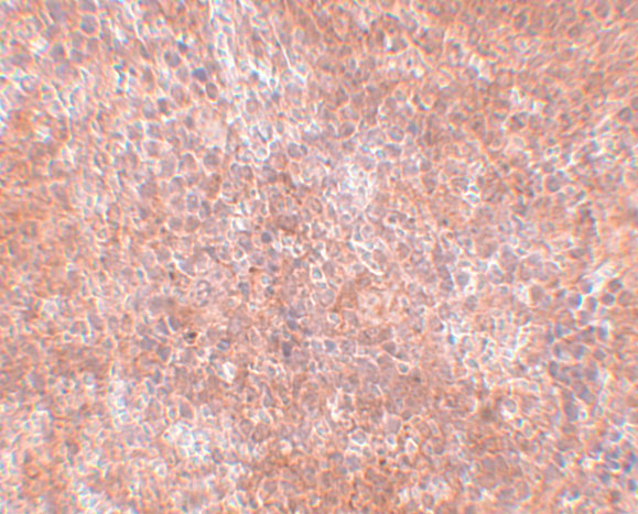 a16718 jmjd8 primary antibodies ihc testing 2