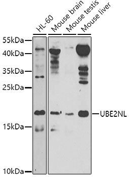 Western blot analysis of extracts of various cell lines, using UBE2NL antibody  at 1:1000 dilution