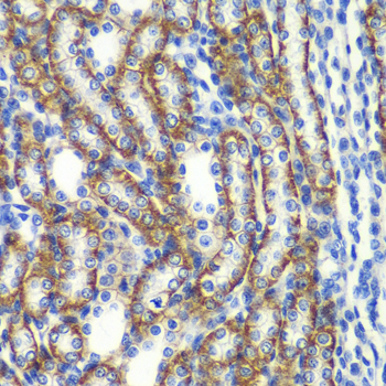 Immunohistochemistry of paraffin-embedded rat kidney using ZFAND3 antibody  at dilution of 1:100 