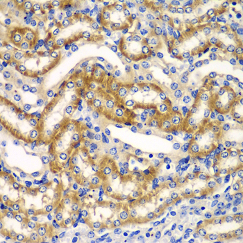 Immunohistochemistry of paraffin-embedded mouse kidney using ZFAND3 antibody  at dilution of 1:100 