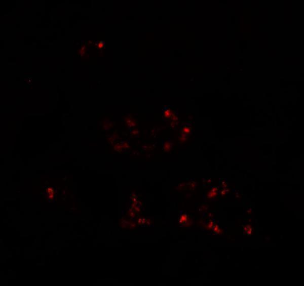 Immunofluorescence of DBX2 in human kidney tissue with DBX2 antibody at 20 μg/mL