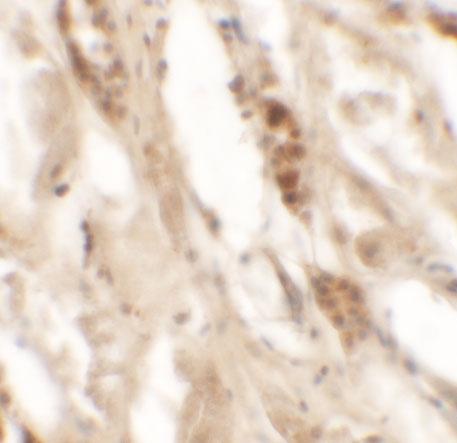 Immunohistochemistry of DBX2 in human kidney tissue with DBX2 antibody at 5 μg/mL