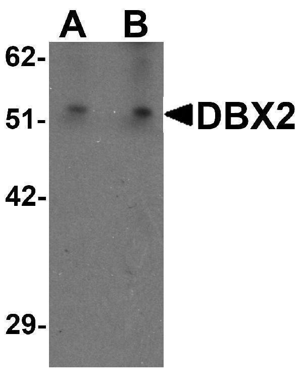 Western blot analysis of WDR18 in rat lung tissue lysate with WDR18 antibody at (A) 1 and (B) 2 μg/mL