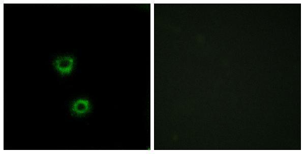 a16756 tmem30c primary antibodies if testing 1