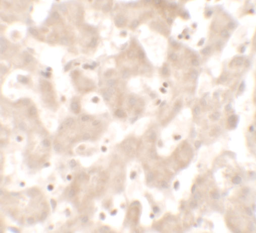 a16774 khdc1 primary antibodies ihc testing 2