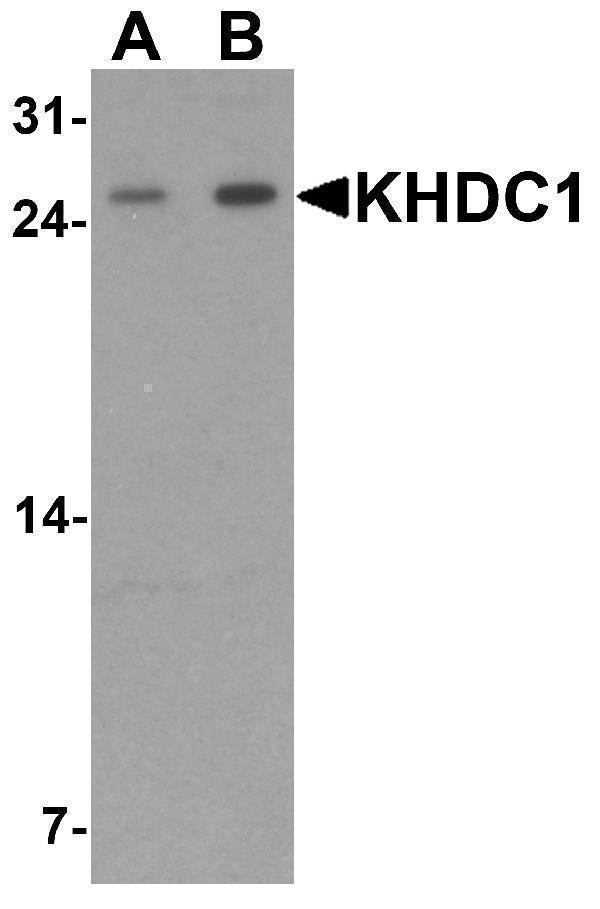 a16774 khdc1 primary antibodies wb testing 1
