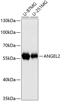 Western blot analysis of extracts of various cell lines, using ANGEL2 antibody  at 1:3000 dilution