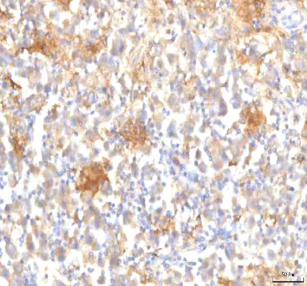 Figure 2. IHC analysis of MFSD12 using anti-MFSD12 antibody (A16855-1). MFSD12 was detected in a paraffin-embedded section of human testicular seminoma tissue. Heat mediated antigen retrieval was performed in EDTA buffer (pH 8.0, epitope retrieval solution). The tissue section was blocked with 10% goat serum. The tissue section was then incubated with 2 microg/ml rabbit anti-MFSD12 Antibody (A16855-1) overnight at 4°C. Peroxidase Conjugated Goat Anti-rabbit IgG was used as secondary antibody and incubated for 30 minutes at 37°C. The tissue section was developed using HRP Conjugated Rabbit IgG Super Vision Assay Kit (Catalog # SV0002) with DAB as the chromogen.