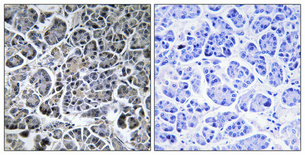 Immunohistochemistry validation of MOB3C using Anti-MOB kinase activator 3C Mob3C Antibody (A16858-2)