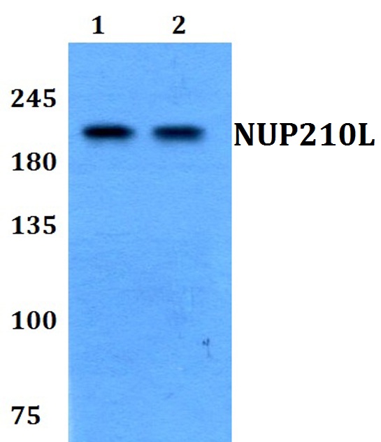 Western blot (WB) analysis of NUP210L polyclonal antibody at 1:500 dilution
Lane1:HEK293T whole cell lysate
Lane2:PC12 whole cell lysate 