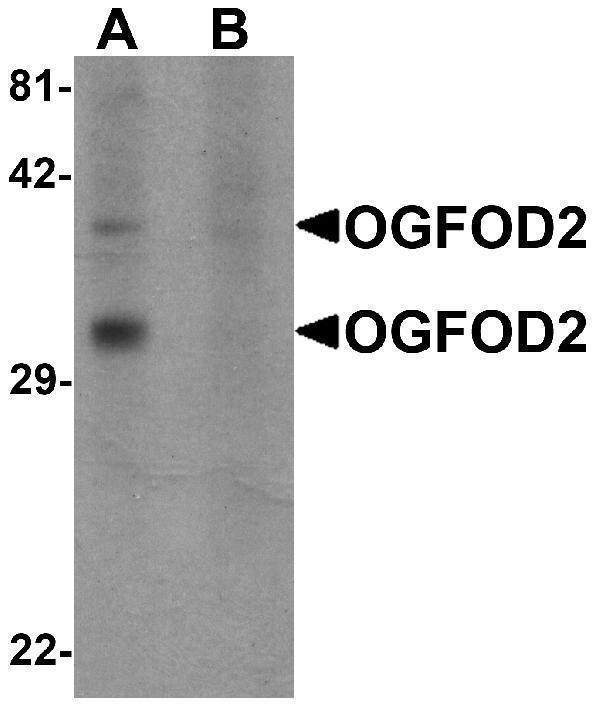 Western blot analysis of OGFOD2 in 293 cell lysate with OGFOD2 antibody at 1 μg/mL in (A) the absence and (B) the presence of blocking peptide