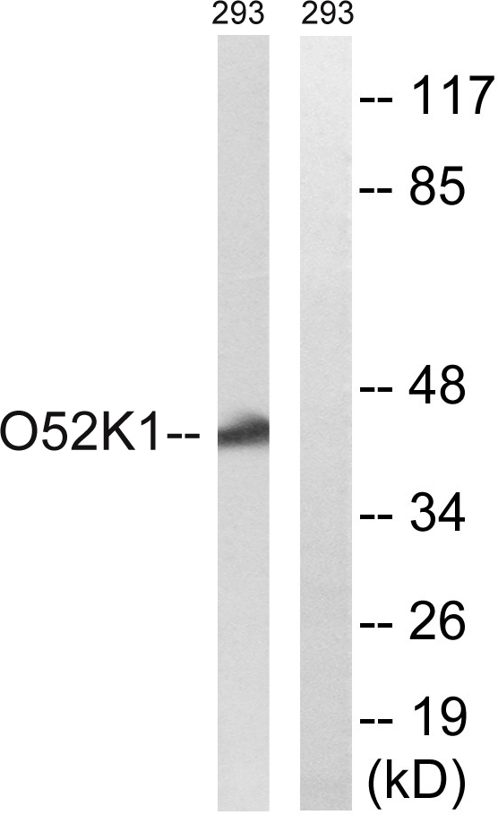 a16887 or52k1 primary antibodies wb testing 1