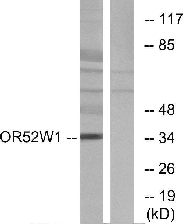 Western blot analysis of lysates from HeLa cells, using OR52W1 Antibody