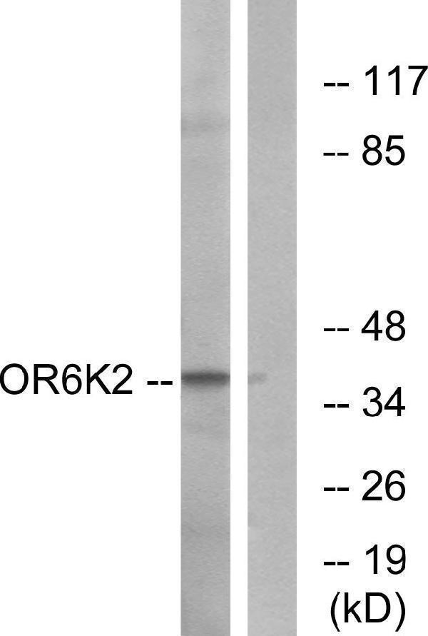 Western blot analysis of lysates from HeLa cells, using OR6K2 Antibody
