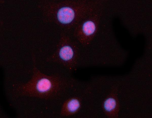 a16917 1 ppm1n primary antibodies if testing 2