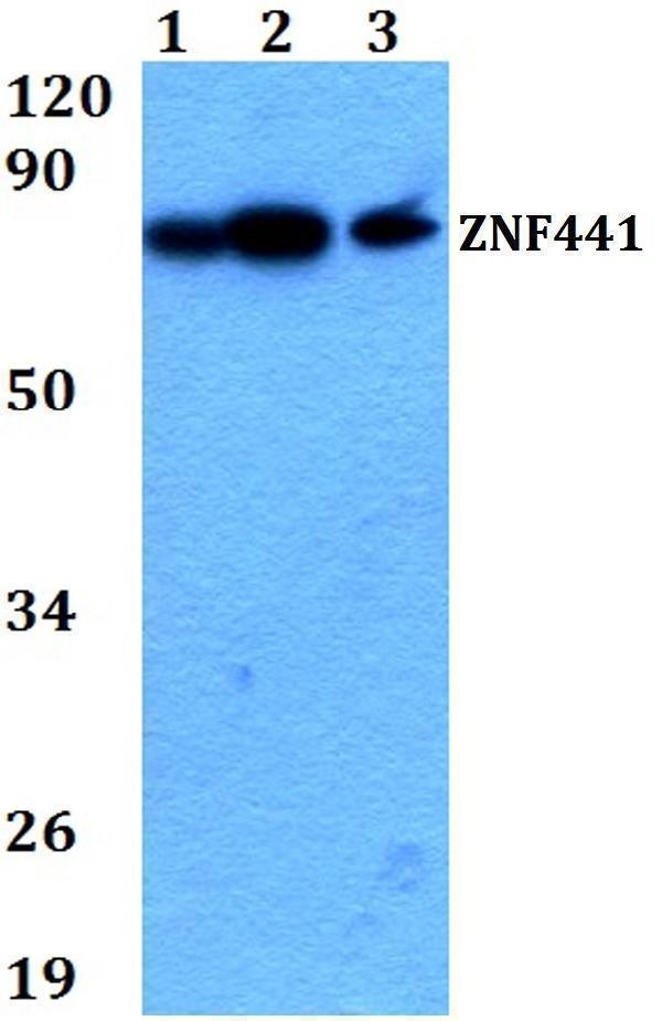 a16949 znf441 primary antiboties wb testing 1