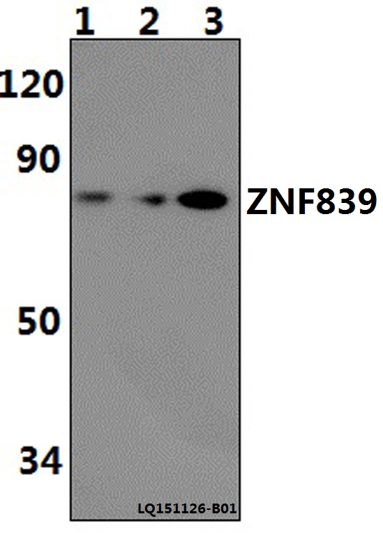 Western blot (WB) analysis of ZNF839 polyclonal antibody at 1:500 dilution
Lane1:H9C2 whole cell lysate(40ug)
Lane2:RAW264