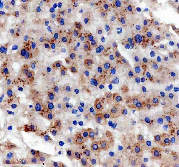 IHC analysis of SLC22A25 using anti-SLC22A25 antibody (A17006-1)