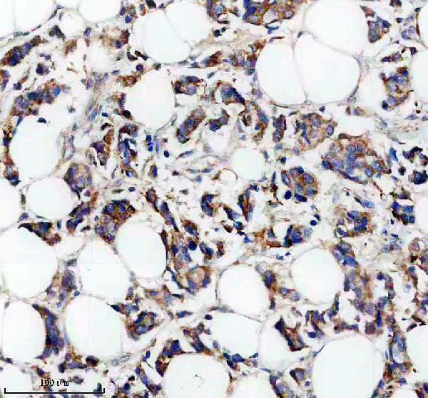 IHC analysis of SLC22A25 using anti-SLC22A25 antibody (A17006-1)