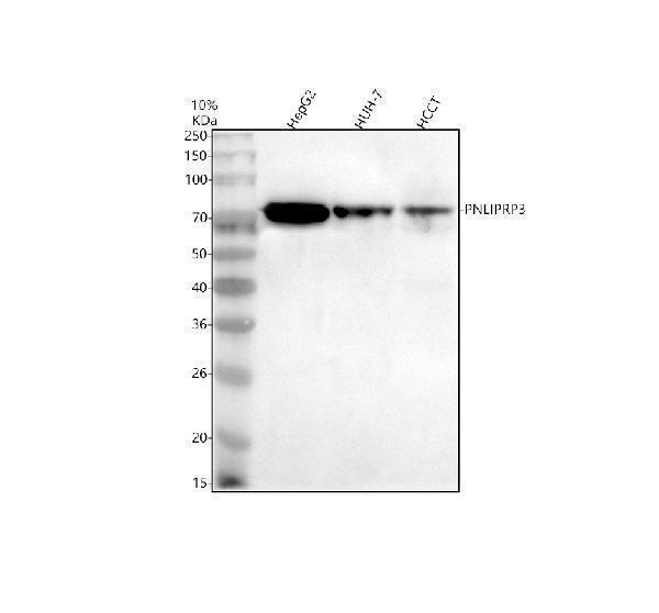 a17011 1 pnliprp3 primary antibodies wb testing 1