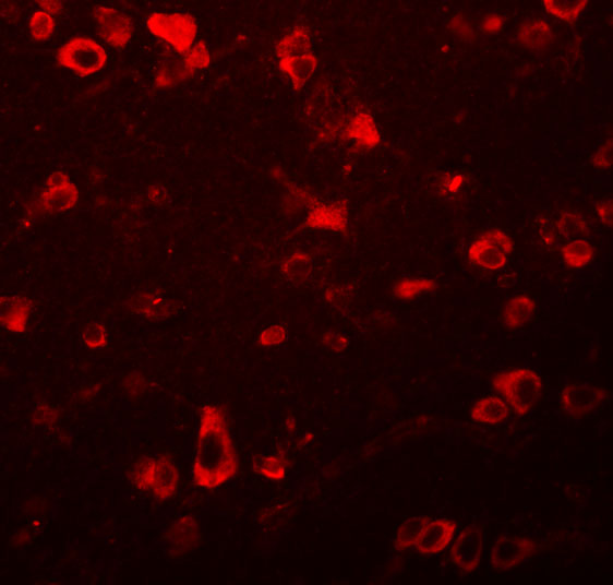 a17028 fam59b primary antibodies if testing 3