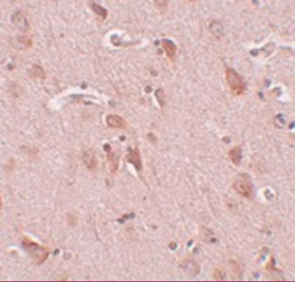 a17028 fam59b primary antibodies ihc testing 2