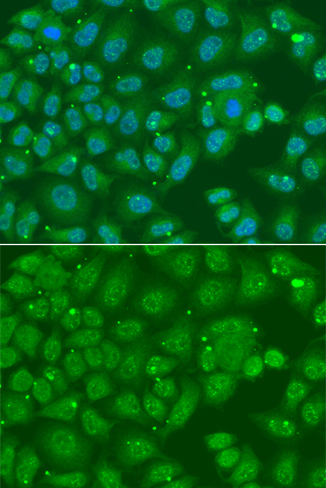 Immunofluorescence analysis of A549 cell using ANXA8L2 antibody