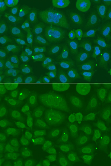 Immunofluorescence analysis of A549 cell using ANXA8L2 antibody