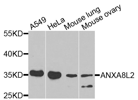 Western blot analysis of extracts of various cells, using ANXA8L2 antibody