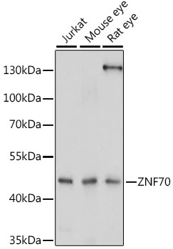Western blot analysis of extracts of various cell lines, using ZNF70 antibody