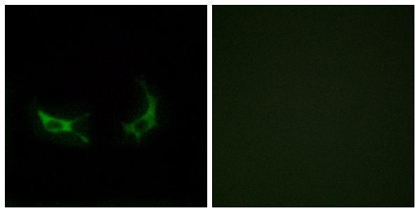 Immunofluorescence analysis of LOVO cells, using OR2M3 Antibody
