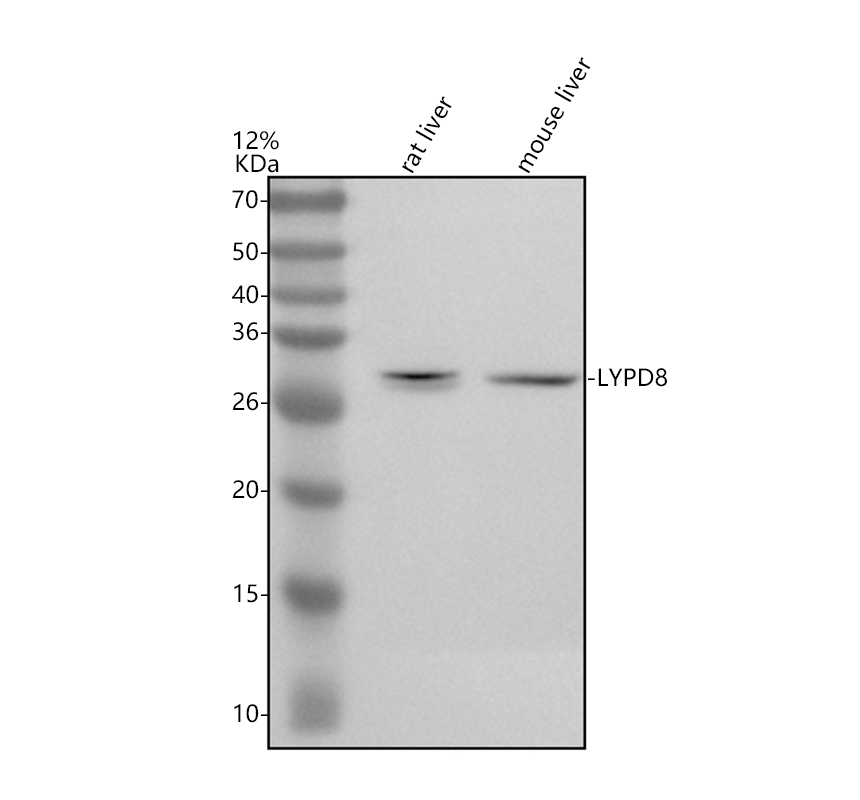 Western blot analysis of LYPD8 using anti-LYPD8 antibody (A17098)