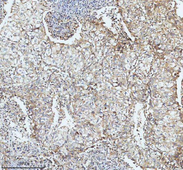  IHC analysis of SBK1 using anti-SBK1 antibody (A17120-1)
