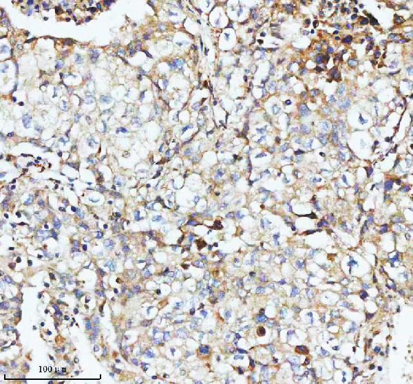  IHC analysis of SBK1 using anti-SBK1 antibody (A17120-1)