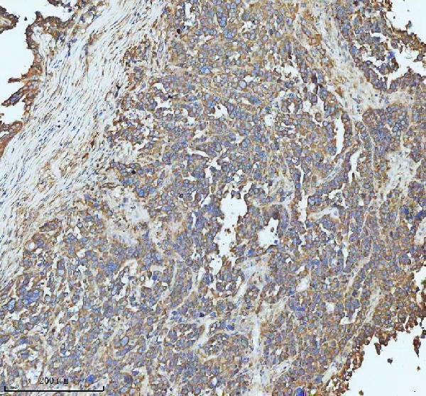 a17120 1 sbk1 primary antibodies ihc testing 4