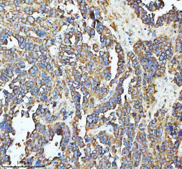 a17120 1 sbk1 primary antibodies ihc testing 5
