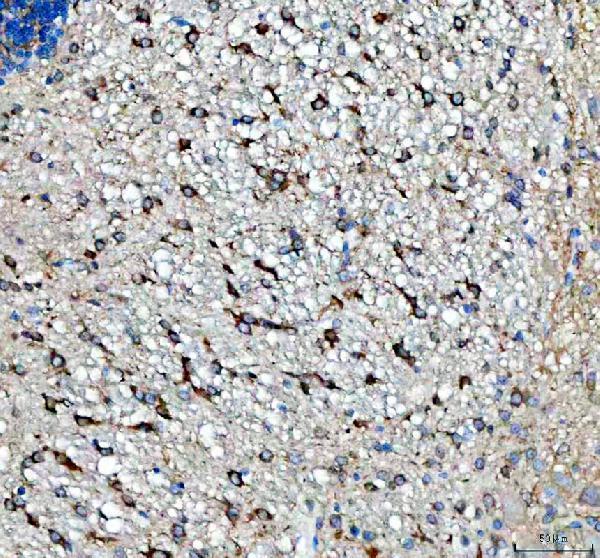 a17120 1 sbk1 primary antibodies ihc testing 6