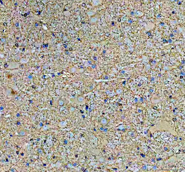 a17120 1 sbk1 primary antibodies ihc testing 7