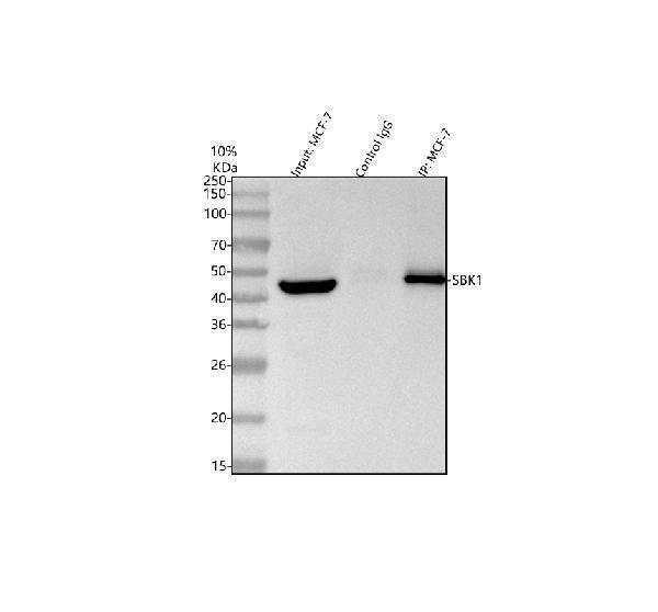 a17120 1 sbk1 primary antibodies ip testing 9