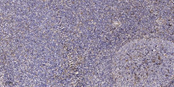 a17131 nrip3 primary antibodies ihc testing 1