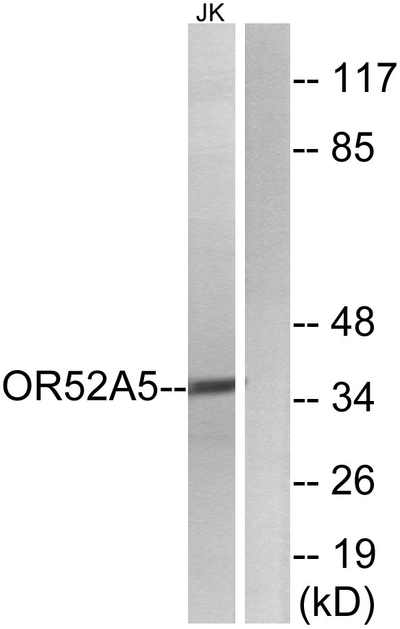 a17138 or52a5 primary antibodies wb testing 1