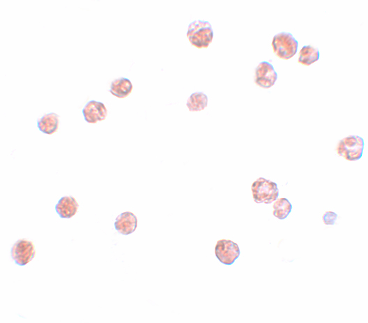 Immunocytochemistry of NALP13 in K562 cells with NALP13 antibody at 2