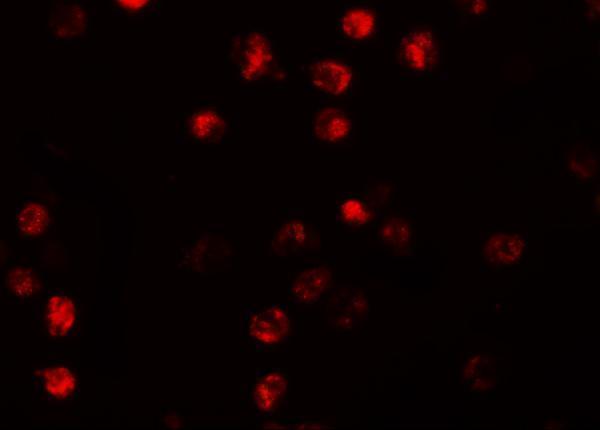 Immunofluorescence of NALP13 in K562 cells with NALP13 antibody at 20 μg/mL