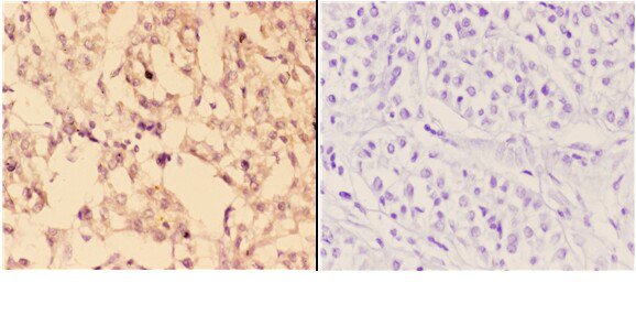a17170 1 ephx3 primary antiboties ihc testing 2