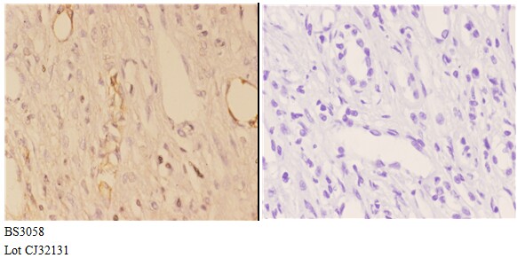 a17170 1 ephx3 primary antiboties ihc testing 3