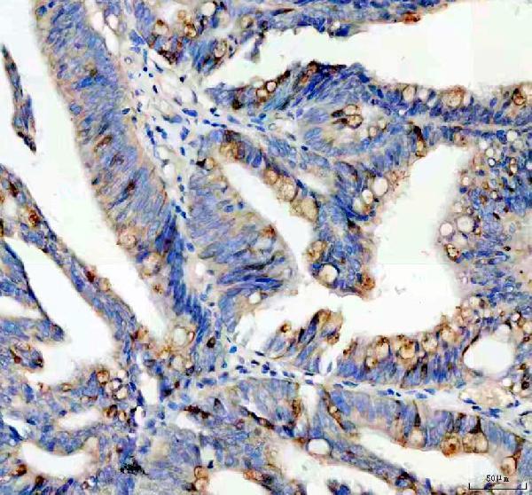 a17177 spink4 primary antibodies ihc testing 1
