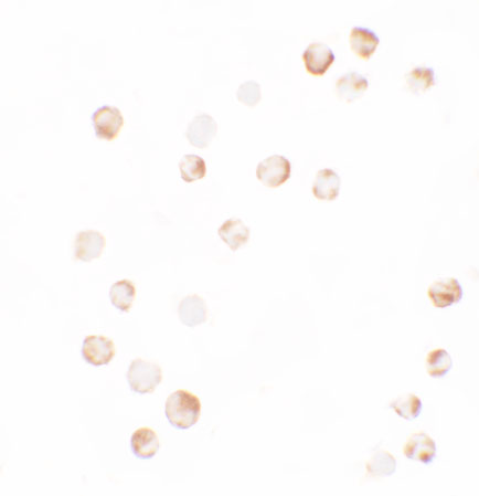 Immunocytochemistry of YPEL4 in SW480 cells with YPEL4 antibody at 2