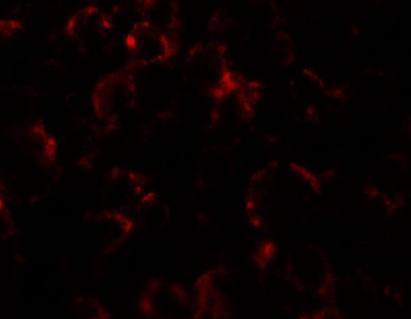 Immunofluorescence of YPEL4 in SW480 cells with YPEL4 antibody at 5 μg/ml