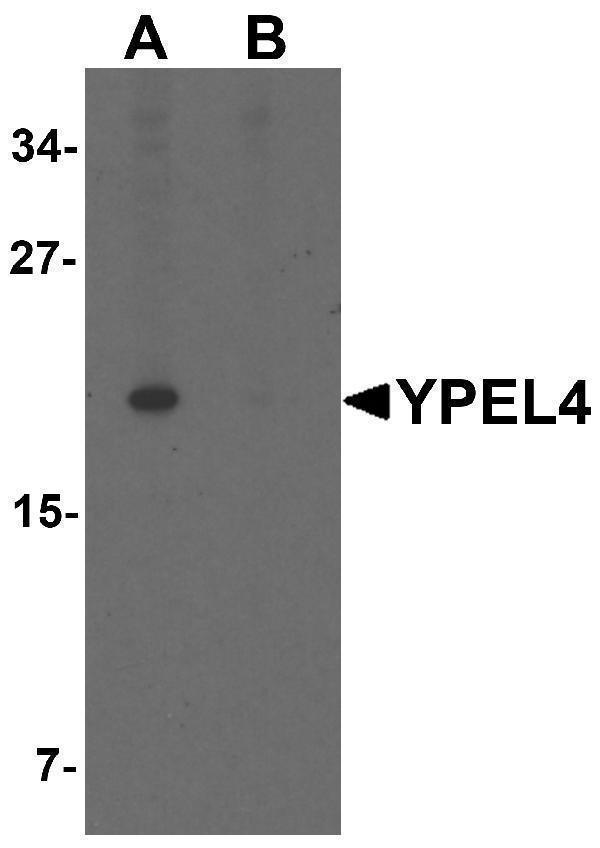 Western blot analysis of YPEL4 in SW480 cell lysate with YPEL4 antibody at 1 μg/mL in (A) the absence and (B) the presence of blocking peptide